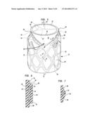 STENT AND IMPLANTABLE VALVE INCORPORATING SAME diagram and image