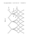 STENT AND IMPLANTABLE VALVE INCORPORATING SAME diagram and image