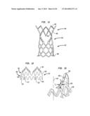 STENT AND IMPLANTABLE VALVE INCORPORATING SAME diagram and image