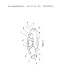 Intervertebral Spacer diagram and image