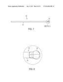 System for Articular Surface Replacement diagram and image