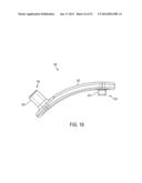 System for Articular Surface Replacement diagram and image