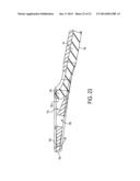 System for Articular Surface Replacement diagram and image