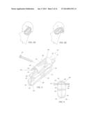 NECK SPARING TOTAL HIP IMPLANT SYSTEM diagram and image