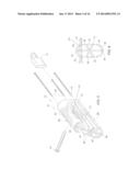 NECK SPARING TOTAL HIP IMPLANT SYSTEM diagram and image