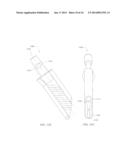 NECK SPARING TOTAL HIP IMPLANT SYSTEM diagram and image