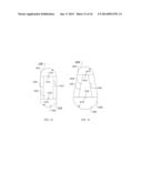 NECK SPARING TOTAL HIP IMPLANT SYSTEM diagram and image