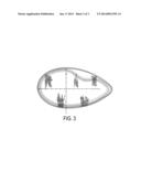 METHOD OF MENDING A GROINAL DEFECT diagram and image