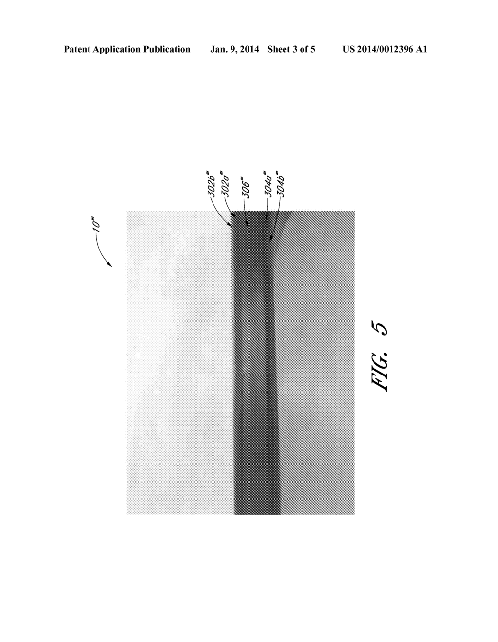 PROSTHETIC FOOT WITH HYBRID LAYUP - diagram, schematic, and image 04