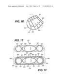 SURGICALLY IMPLANTABLE DEVICES WITH A COMPUTER, A FARADAY CAGE AND AT     LEAST ONE INTERNAL FLEXIBILITY SIPE diagram and image