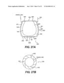 SURGICALLY IMPLANTABLE DEVICES WITH A COMPUTER, A FARADAY CAGE AND AT     LEAST ONE INTERNAL FLEXIBILITY SIPE diagram and image