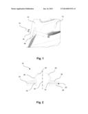 SEALING BUSH FOR A WINDSHIELD WIPING DEVICE diagram and image
