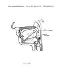 SYSTEMS AND METHODS FOR TREATMENT OF SLEEP APNEA diagram and image