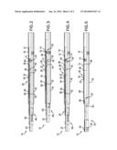 FORMATION TREATMENT SYSTEM diagram and image