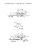 EXPANDABLE DOWNHOLE SEAT ASSEMBLY diagram and image