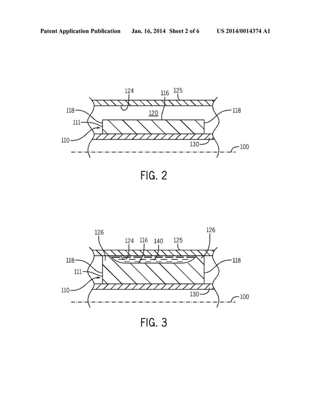 SWELLABLE PACKER - diagram, schematic, and image 03