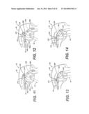 Medical Device Having An Improved Coating diagram and image