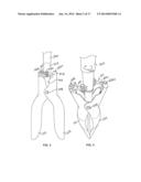 Single Handle Post Hole Digger diagram and image