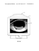 APPARATUSES AND METHODS FOR DETERMINING TEAR FILM BREAK-UP TIME AND/OR FOR     DETECTING LID MARGIN CONTACT AND BLINK RATES, PARTICULARY FOR DIAGNOSING,     MEASURING, AND/OR ANALYZING DRY EYE  CONDITIONS AND SYMPTOMS diagram and image