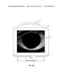 APPARATUSES AND METHODS FOR DETERMINING TEAR FILM BREAK-UP TIME AND/OR FOR     DETECTING LID MARGIN CONTACT AND BLINK RATES, PARTICULARY FOR DIAGNOSING,     MEASURING, AND/OR ANALYZING DRY EYE  CONDITIONS AND SYMPTOMS diagram and image