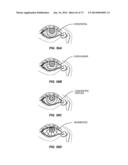 APPARATUSES AND METHODS FOR DETERMINING TEAR FILM BREAK-UP TIME AND/OR FOR     DETECTING LID MARGIN CONTACT AND BLINK RATES, PARTICULARY FOR DIAGNOSING,     MEASURING, AND/OR ANALYZING DRY EYE  CONDITIONS AND SYMPTOMS diagram and image