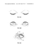 APPARATUSES AND METHODS FOR DETERMINING TEAR FILM BREAK-UP TIME AND/OR FOR     DETECTING LID MARGIN CONTACT AND BLINK RATES, PARTICULARY FOR DIAGNOSING,     MEASURING, AND/OR ANALYZING DRY EYE  CONDITIONS AND SYMPTOMS diagram and image