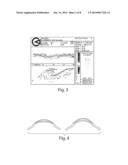 TREATMENT OF OPHTHALMIC CONDITIONS diagram and image