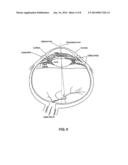 TREATMENT OF OPHTHALMIC CONDITIONS diagram and image