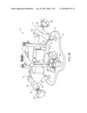 AUXILIARY DEVICE FOR ARTICULATOR diagram and image