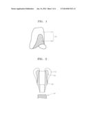DENTAL IMPLANT ABUTMENT AND METHOD FOR MANUFACTURING SAME diagram and image