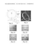 SENSITIVE INTRACAVITY BIOSENSING PLATFORM AND METHODS FOR DETECTION     THEREWITH diagram and image