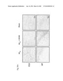 METHOD OF INHIBITING TAU PHOSPHORYLATION diagram and image