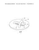 BARIATRIC DEVICE AND METHOD diagram and image