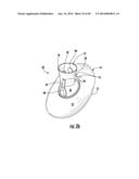 BARIATRIC DEVICE AND METHOD diagram and image