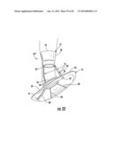 BARIATRIC DEVICE AND METHOD diagram and image