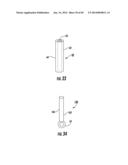 BARIATRIC DEVICE AND METHOD diagram and image