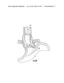 BARIATRIC DEVICE AND METHOD diagram and image