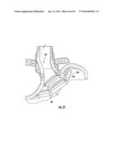 BARIATRIC DEVICE AND METHOD diagram and image