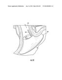 BARIATRIC DEVICE AND METHOD diagram and image