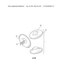 BARIATRIC DEVICE AND METHOD diagram and image