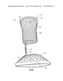 BARIATRIC DEVICE AND METHOD diagram and image