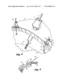 LAPAROSCOPIC SCAFFOLD ASSEMBLY diagram and image