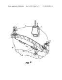 LAPAROSCOPIC SCAFFOLD ASSEMBLY diagram and image