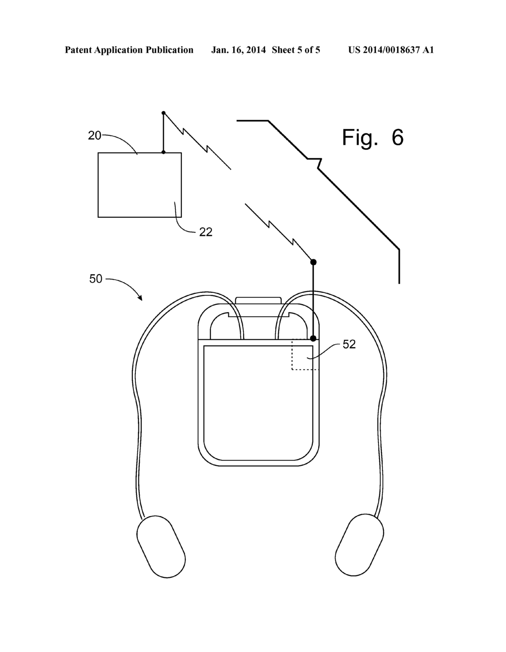 Cloud-Based Monitoring of Medical Devices - diagram, schematic, and image 06