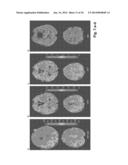 SYSTEM FOR ASSESSING TISSUE SUBSTANCE EXTRACTION diagram and image