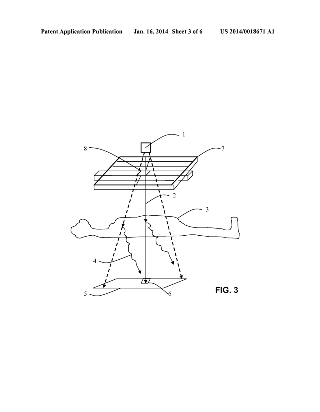 Medical Imaging System and Method with Separate Primary and Scattered     Components - diagram, schematic, and image 04