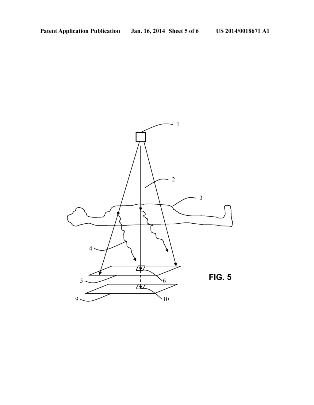 Medical Imaging System and Method with Separate Primary and Scattered     Components - diagram, schematic, and image 06