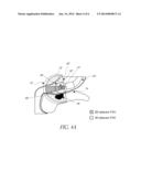 IONIZING RADIATION DETECTOR FOR USE WITH ENDOSCOPIC ULTRASOUND diagram and image