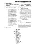 Devices and Systems for Carotid Body Ablation diagram and image