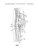 Devices and Systems for Carotid Body Ablation diagram and image